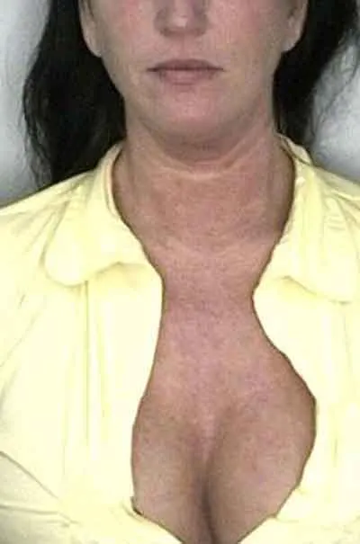 Gabriella, 37 år